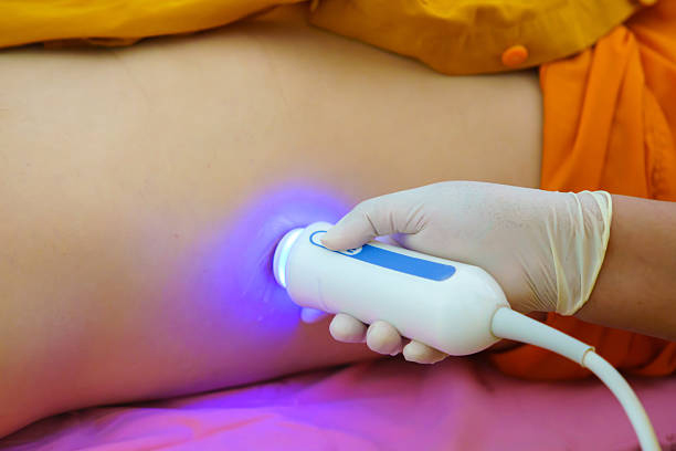 FibroScan